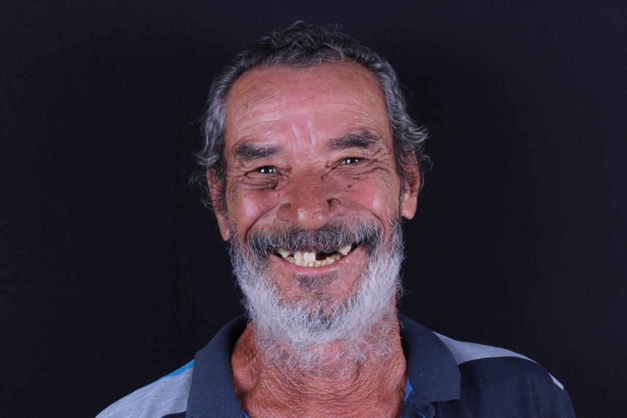 Sorriso antes do tratamento