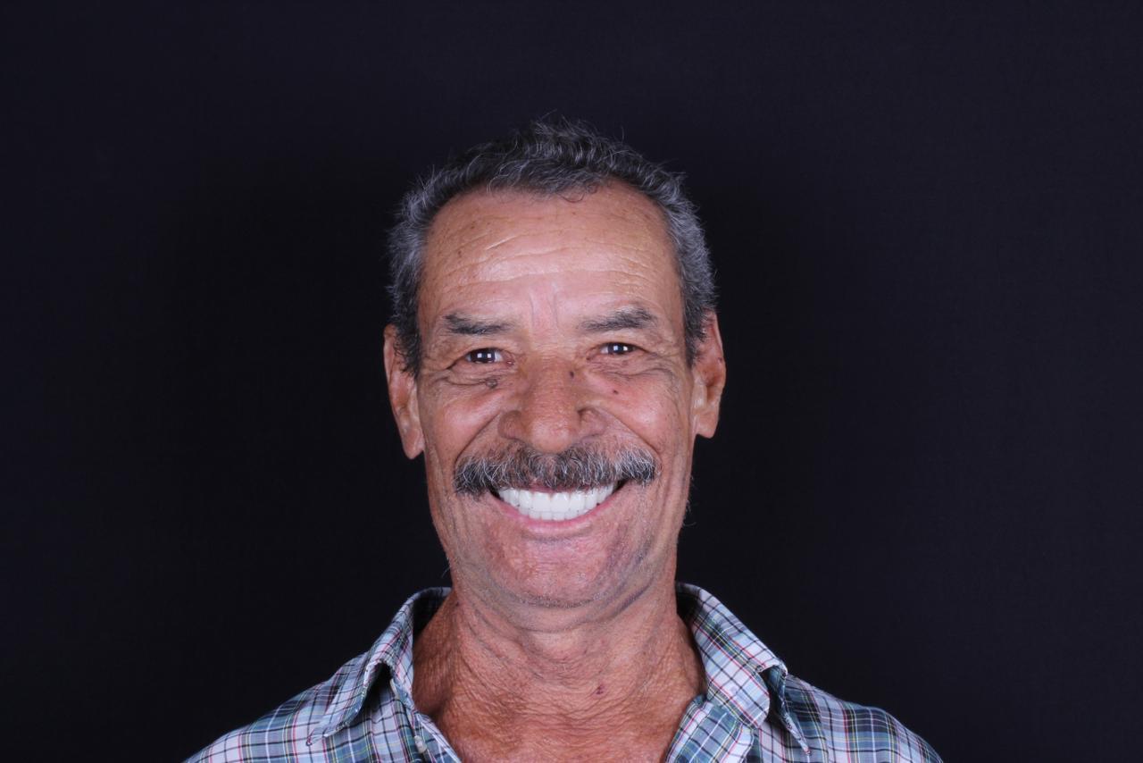 Sorriso depois do tratamento